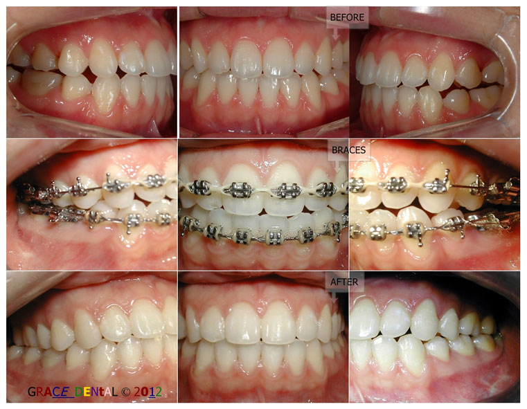 Ortho Case - Before & After