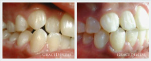Ortho Cases